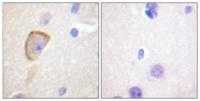 MOR-1 Polyclonal Antibody