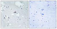 MOR-1 Polyclonal Antibody