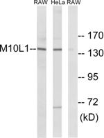 MOV10L1 Polyclonal Antibody