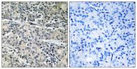 MP68 Polyclonal Antibody