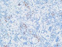 MPO Polyclonal Antibody