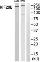 MPP1 Polyclonal Antibody