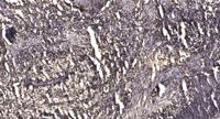 MPP1 Polyclonal Antibody