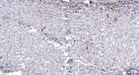 MPP9 Polyclonal Antibody