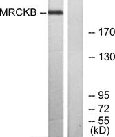 MRCKβ Polyclonal Antibody