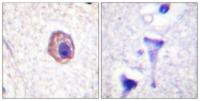 MRLC2 Polyclonal Antibody