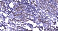 MRP3 Polyclonal Antibody