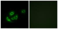 MRP-L11 Polyclonal Antibody