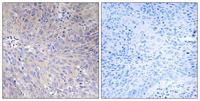 MRP-L11 Polyclonal Antibody