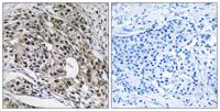 MRP-L13 Polyclonal Antibody