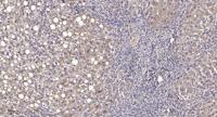 MRP-L14 Polyclonal Antibody