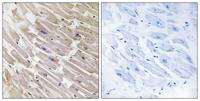 MRP-L16 Polyclonal Antibody