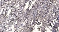 MRP-L17 Polyclonal Antibody