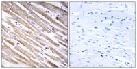 Ribosomal Protein L3L Polyclonal Antibody