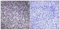 Ribosomal Protein L40 Polyclonal Antibody