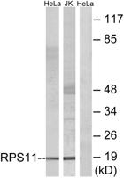 Ribosomal Protein S11 Polyclonal Antibody