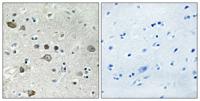 Ribosomal Protein S12 Polyclonal Antibody