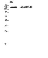 ADAMTS-18 Polyclonal Antibody