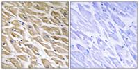 MRP-L39 Polyclonal Antibody