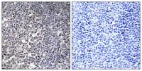 MRP-S16 Polyclonal Antibody