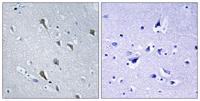 MRP-S2 Polyclonal Antibody