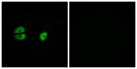 MRP-S22 Polyclonal Antibody