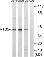 MRP-S35 Polyclonal Antibody