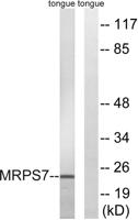 MRP-S7 Polyclonal Antibody