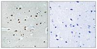 MRTF-A Polyclonal Antibody