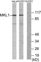 MRTF-A Polyclonal Antibody