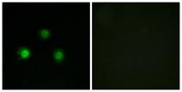 MSH2 Polyclonal Antibody