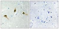 MSH2 Polyclonal Antibody