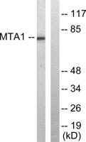 MTA1 Polyclonal Antibody