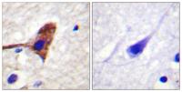 mTOR Polyclonal Antibody