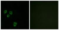 Mucin 16 Polyclonal Antibody