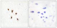 MVK Polyclonal Antibody