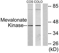 MVK Polyclonal Antibody