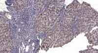 MxB Polyclonal Antibody