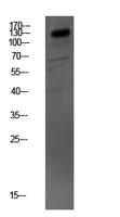 MYBPC3 Polyclonal Antibody