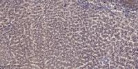 MYBPC3 Polyclonal Antibody