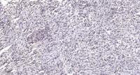 MYH Polyclonal Antibody