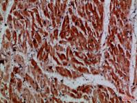 MYH6/MYH7 Polyclonal Antibody