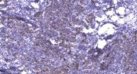 MYL2 Polyclonal Antibody