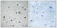 MYLIP Polyclonal Antibody