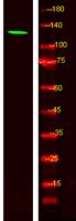 MYO1F Polyclonal Antibody