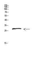 MYOZ2 Polyclonal Antibody