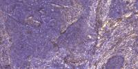 MYOZ2 Polyclonal Antibody