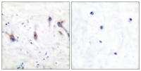 Myp Polyclonal Antibody