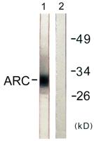 Myp Polyclonal Antibody