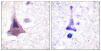 MYPT1 Polyclonal Antibody